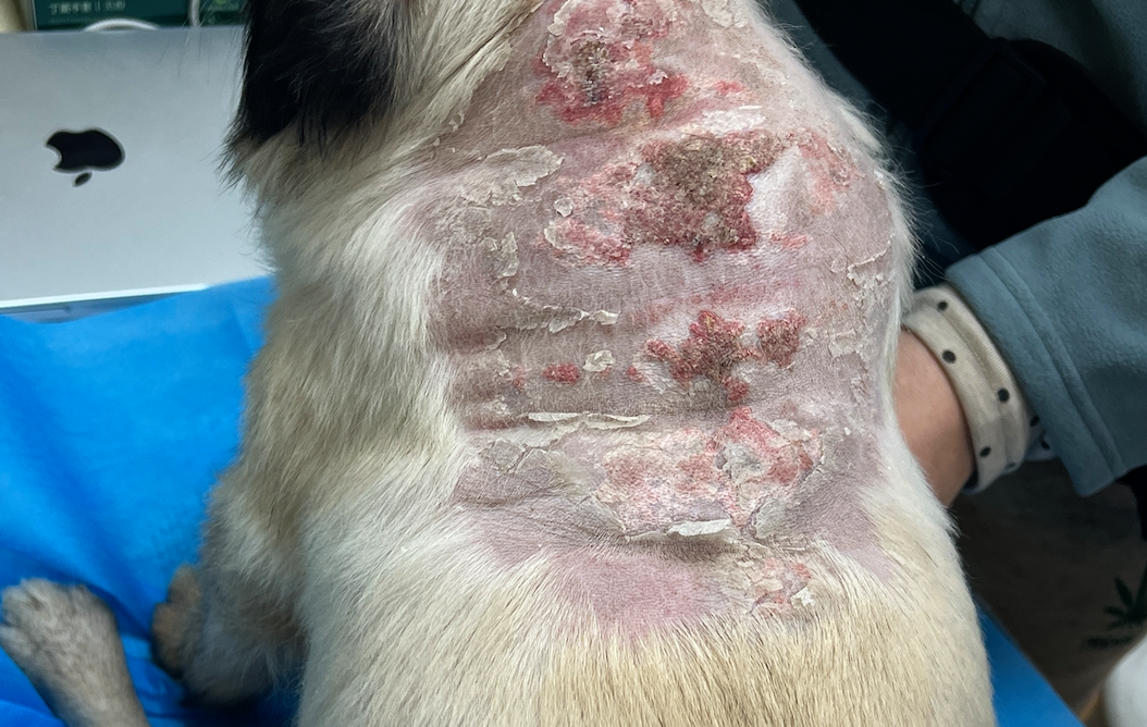 Iatrogenic Cushing’s syndrome