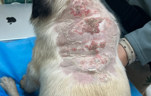 Iatrogenic Cushing’s syndrome